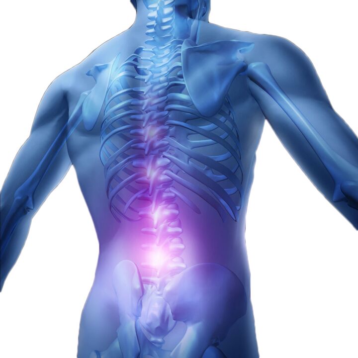 Muscle spasms and stiffness cause severe pain